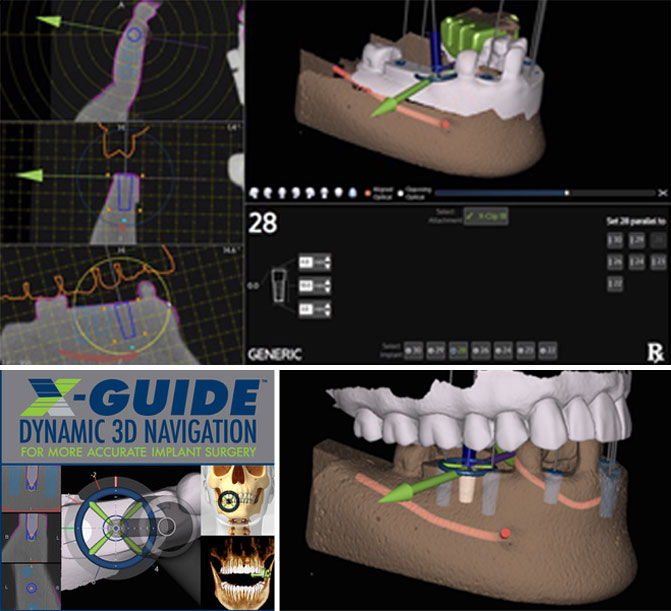 The XGuide® Dynamic 3D Navigation System Dr. Chaudhry